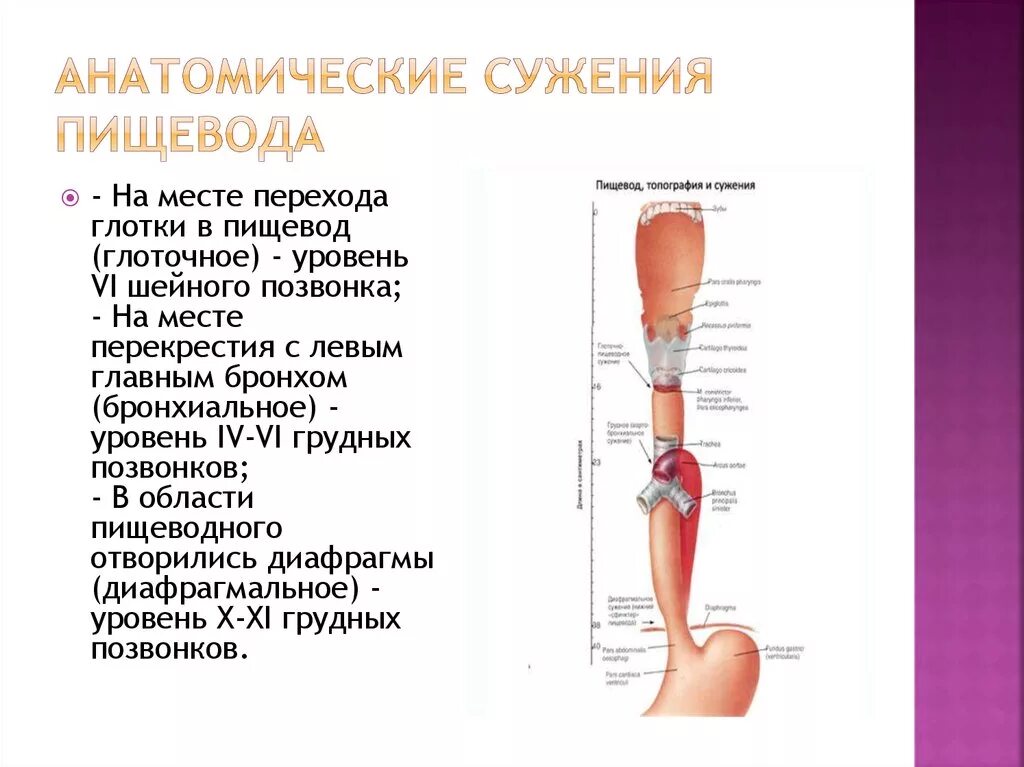 Уровни сужения пищевода