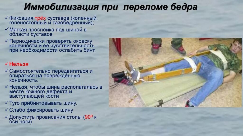 Перелом бедра шина дитерихса. Транспортная иммобилизация при переломе бедренной кости. Шина для транспортной иммобилизации при переломе бедра. Иммобилизация при переломе бедренной кости. Транспортная иммобилизация при переломе костей конечностей.