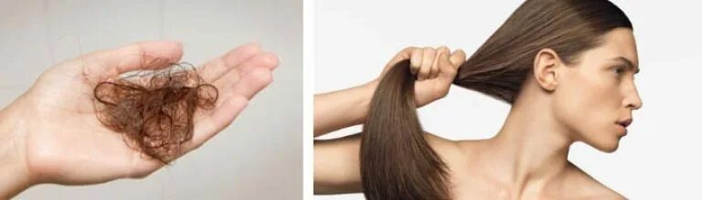 Сколько волос есть у человека. Норма выпадения волос у женщин. Волосы норма выпадения волос. Норма выпадения волос в день.