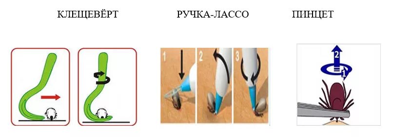Как вытащить клеща у человека в домашних. Как удалить клеща у человека шприцом. Правила удаления присосавшегося клеща. Алгоритм извлечения клеща. Алгоритм удаления клеща.