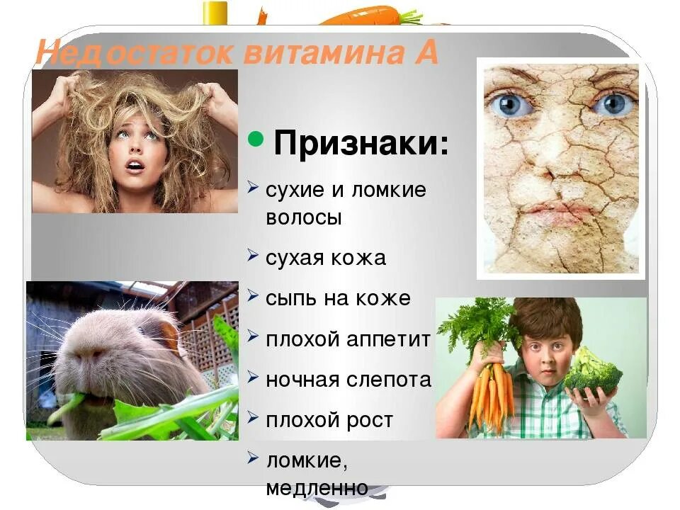 Восполнение дефицита витаминов. Дефицит витамина д. Дефицит витамина а. Авитаминоз цинга и рахит. Недостаточность витамина а.