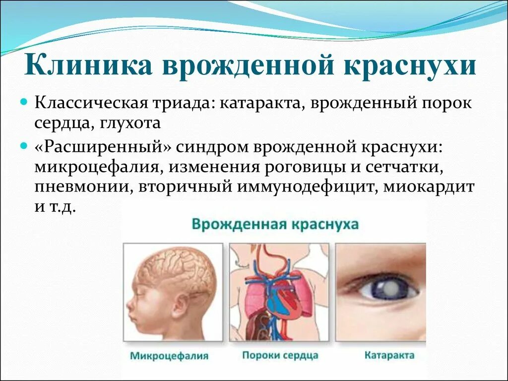 Синдром триады