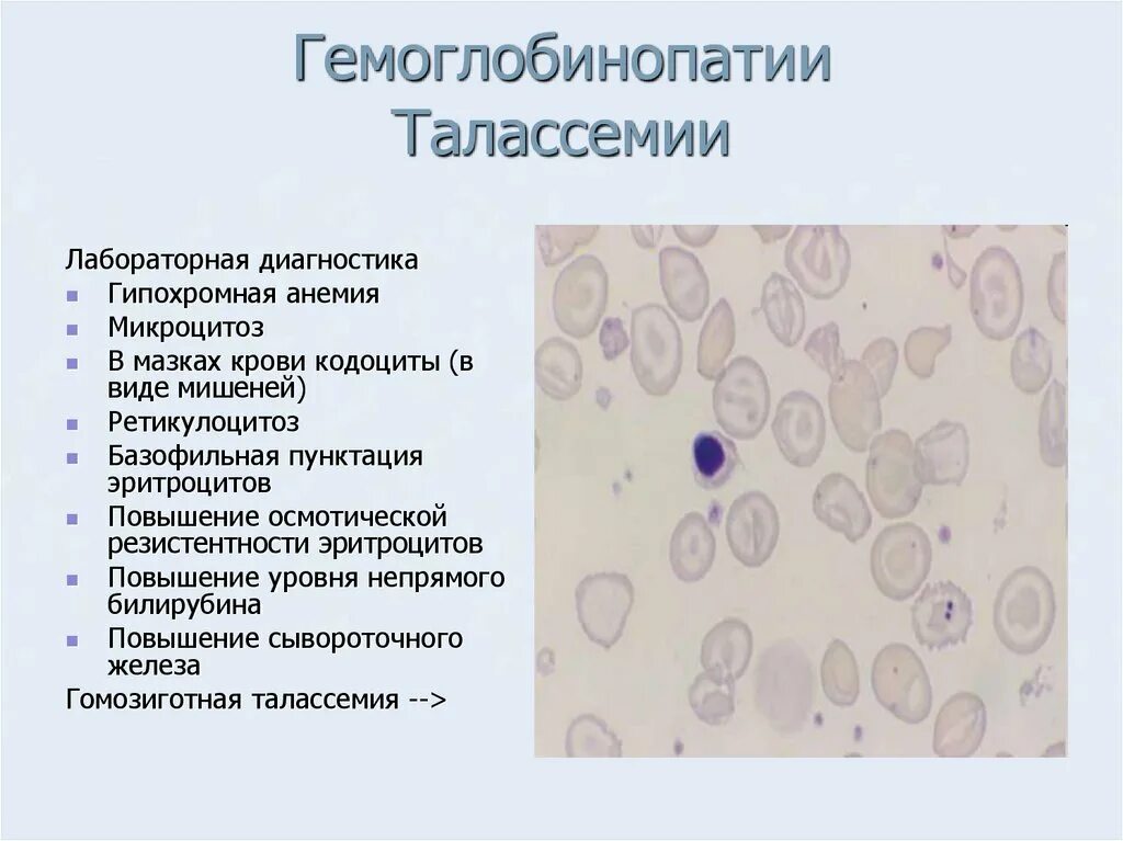 Микроцитоз в общем анализе что это