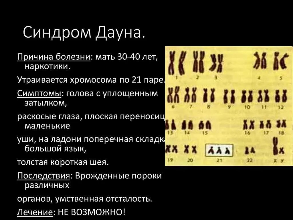 Болезнь дауна код по мкб 10. Синдром дауна причина болезни. синдром дауна причины заболевания. основная причина болезни дауна.