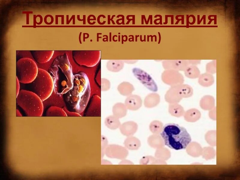 Возбудитель тропической малярии. Презентация на тему малярия. Течение тропической малярии