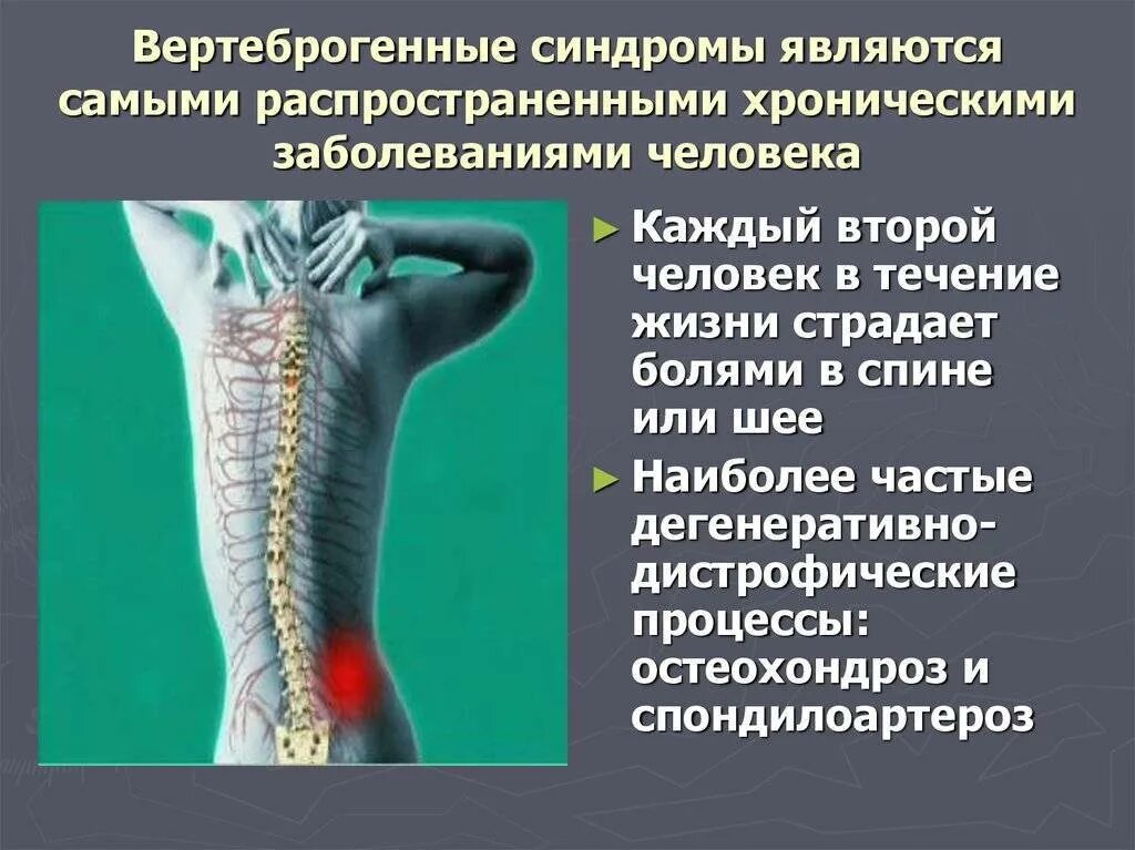 Болезни спины и позвоночника. Вертеброгенная люмбалгия. Остеохондроз поясничного отдела позвоночника люмбалгия. Дегенеративно дистрофическая болезнь позвоночника. Синдром цервикалгии люмбалгии.