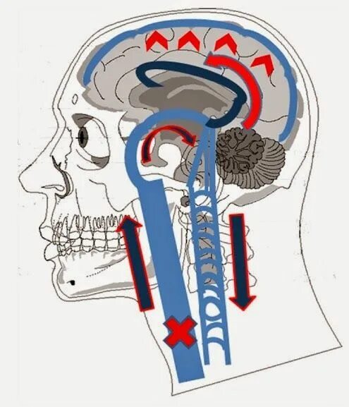 Отток крови от головного мозга. Затрудненный венозный отток головного мозга. Венозный отток из головы.