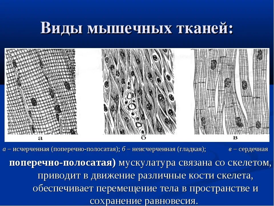 Клетка сердечной поперечно полосатой мышечной ткани. Скелетная сердечная и гладкая мышечная ткань. Поперечно-полосатая Скелетная мышечная ткань схема. Поперечно исчерченная Скелетная мышечная ткань. Строение поперечно полосатой скелетной мышечной ткани.