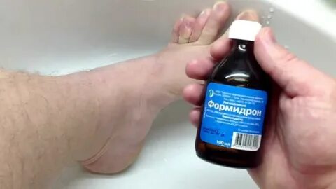 Чем обработать ноги чтобы не потели