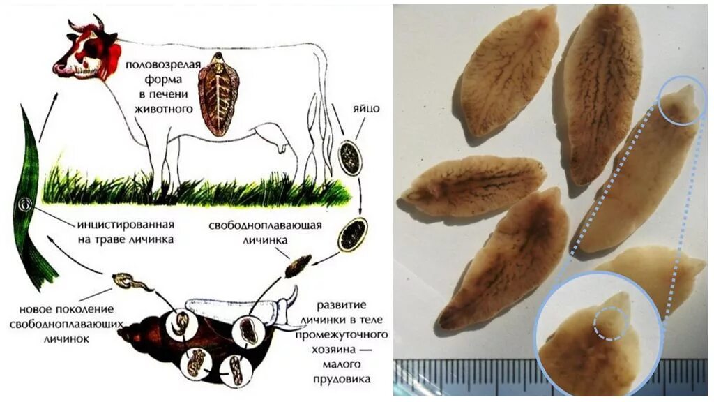 Печеночный сосальщик факторы заражения. Печеночный сосальщик профилактика фасциолеза. Печеночный сосальщик возбудитель фасциолеза. Печеночный сосальщик тип животного