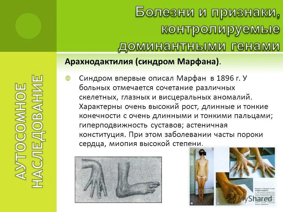 врожденный вывих бедра у человека наследуется как аутосомный. арахнодактилия наследуется как доминантный. арахнодактилия наследуется как доминантный. арахнодактилия наследуется как доминантный. арахнодактилия наследуется как доминантный.