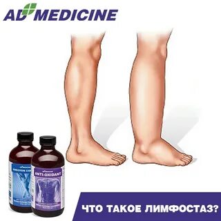 Как разогнать отеки ног