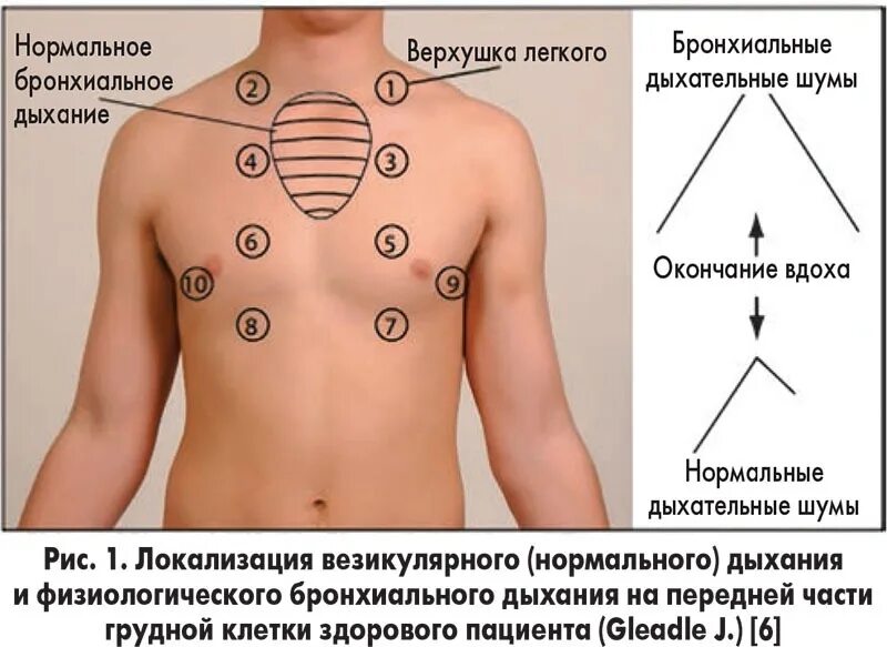 Хрипы в легких звук