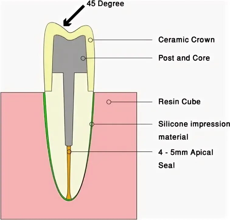 Core crowns