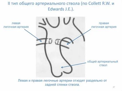 Тест общий артериальный ствол