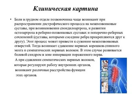 Грудной хондроз симптомы у женщин где болит