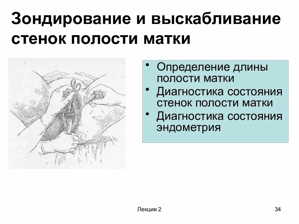 Как происходит выскабливание. Зондирование и выскабливание стенок полости. Зондирование и выскабливание стенок полости матки. Зондирование маточной полости. Зондирование матки в гинекологии.