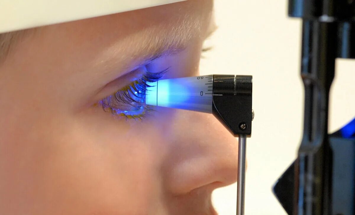Применение лазера в медицине. Тонометрия глаза. Бесконтактная тонометрия глаза. Лазеростимуляция глаз.