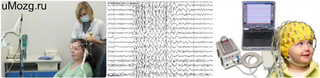 Энцефалограмма. ЭЭГ. ЭЭГ головного мозга. ЭЭГ детям.