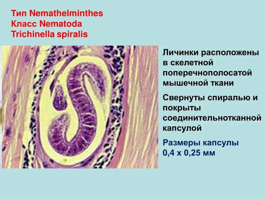 Инкапсулированные личинки трихинеллы в мышечной ткани. Строение личинки трихинеллы. Личинка трихинеллы в мышцах препарат. Микропрепарат личинок трихинеллы.