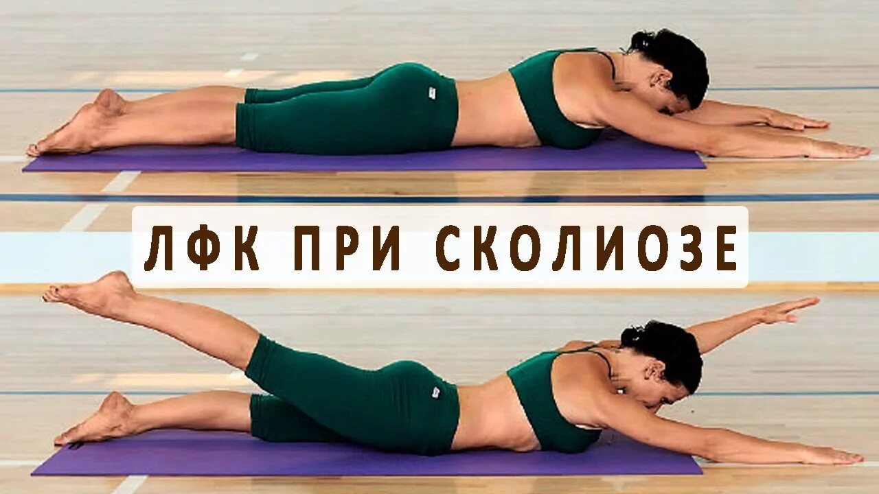 Лфк сколиоз 1 степени упражнения. Гимнастика лфк для детей. Корректирующая гимнастика. Лечебная гимнастика для детей. Гимнастика лфк при сколиозе 2 степени.
