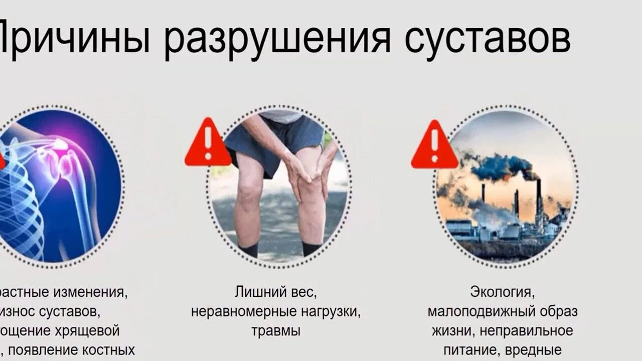 Продукты разрушающие суставы. Продукты разрушающие суставы и хрящи. инфекции разрушающие сустав. от чего разрушаются суставы.