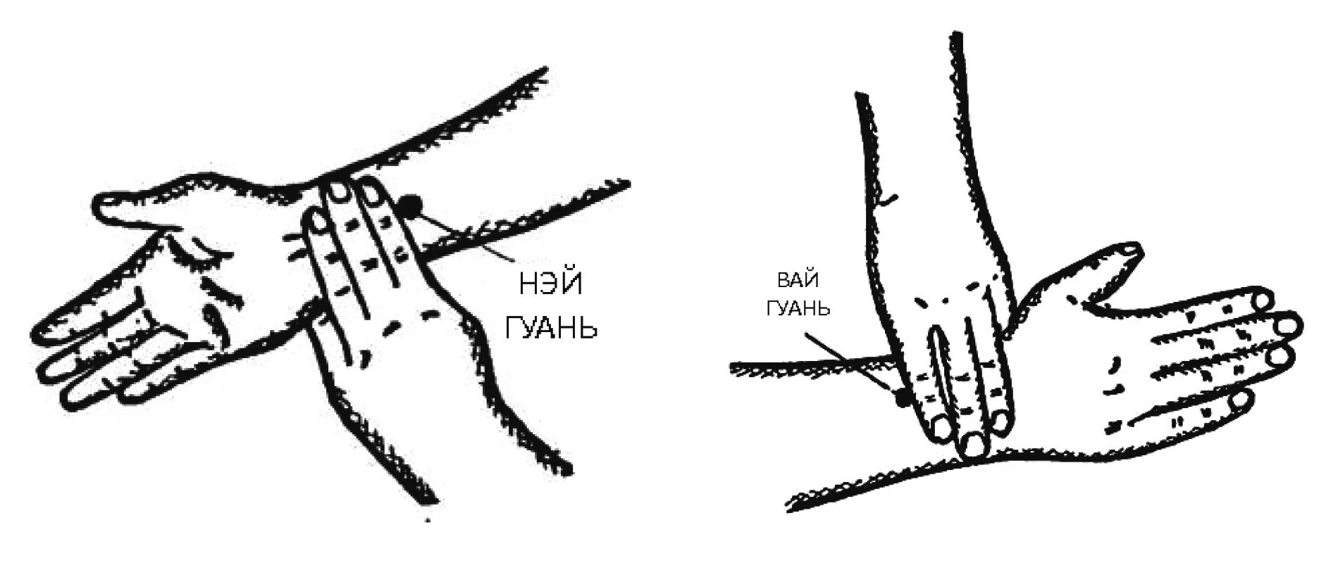 Точка mc 6. Точка мс6 Нэй-Гуань. Mc6 Нэй-Гуань точка акупунктуры. Расположение точки Нэй-Гуань МС-6. Мс6 точка акупунктуры.