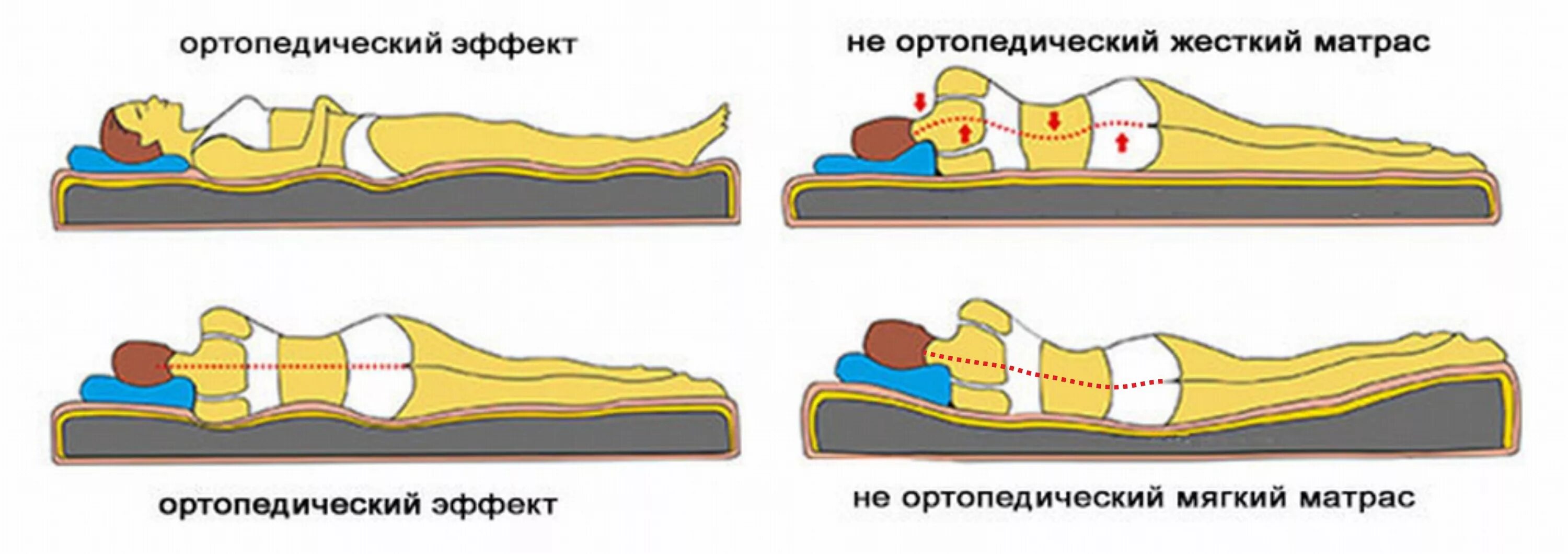 Сколько времени надо лежать. Правильный матрас для позвоночника. Матрас для позвоночника с грыжей. Матрас ортопедический для больной спины. Позвоночник на матрасе.