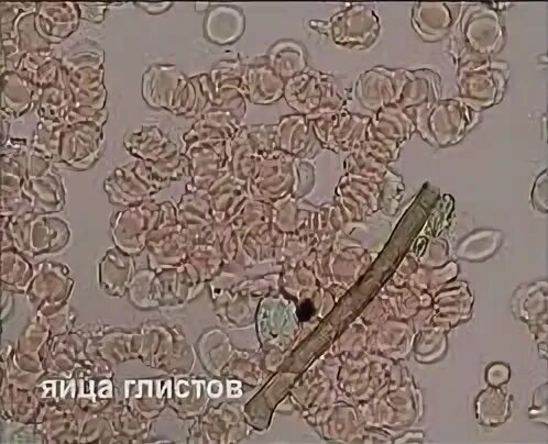 Микроскопия кала яйца гельминтов. Яйца гельминтов микроскопия атлас. Яйца глистов микроскопия. Микроскопия кала копрограмма. Перевариваемая растительная клетчатка в кале у ребенка