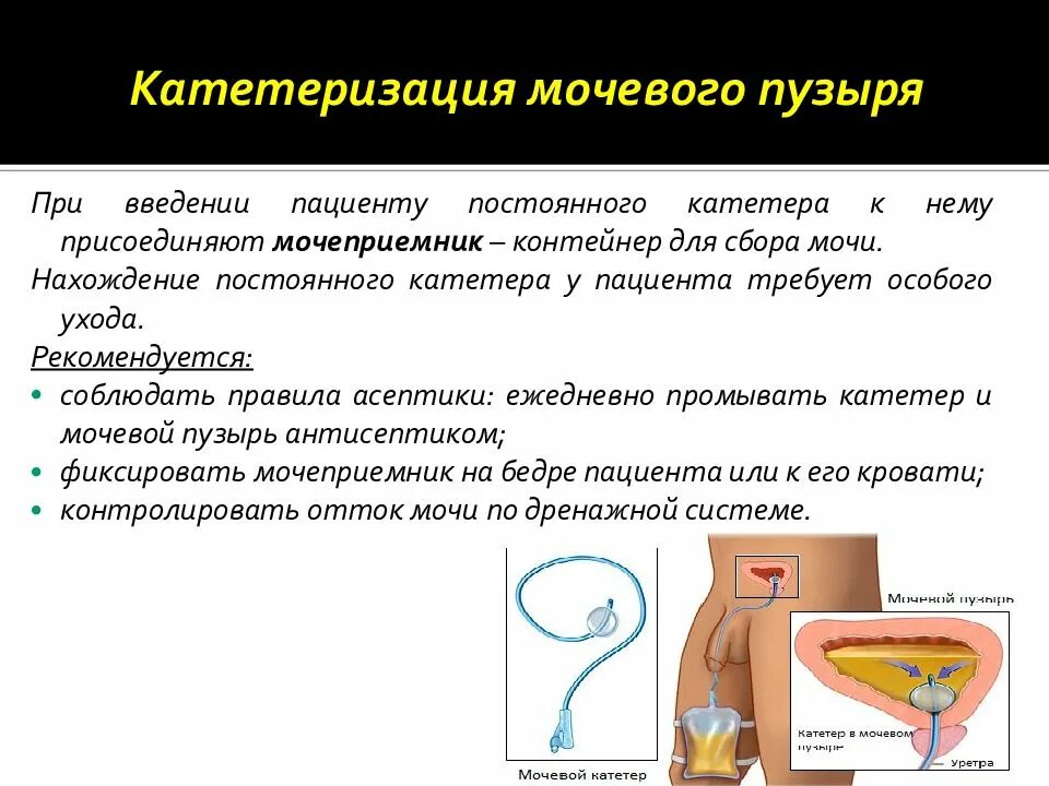 Проведение катетеризации мочевого пузыря алгоритм. Катетеризация мочевого пузыря. катетеризация женщины алгоритм.