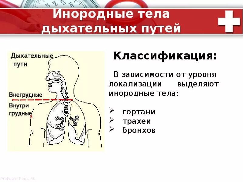 Инородное тело в дыхательных путях. Инородные тела верхних дыхательных путей. Симптомы попадания инородного тела в дыхательные пути. Инородные тела верхних дыхательных путей классификация. Застревают крошки