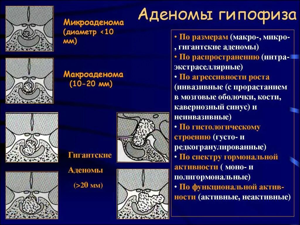 Виды гипофиза. Аденома гипофиза классификация. Макроадееома гипофиза. Аденома гипофиза этиология.