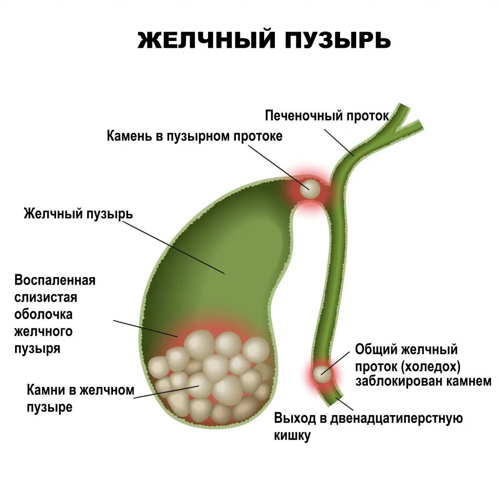 Почему болит желчный