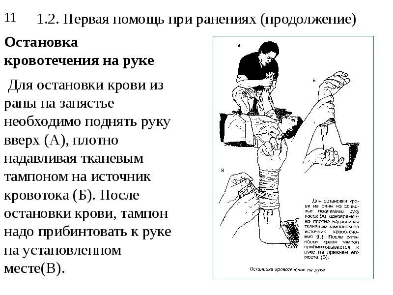 Правила оказания первой помощи пострадавшему при ранениях. Оказание неотложной помощи при ранениях с использованием жгута. Последовательность действий при оказании первой помощи при ранах. Первая помощь при кровотечениях и ранениях алгоритм. 1 медицинская помощь при ранении