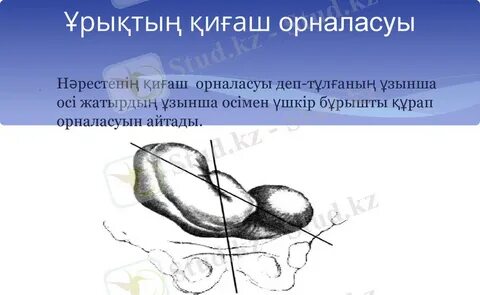 Полярлық секс бойынша стриптиз