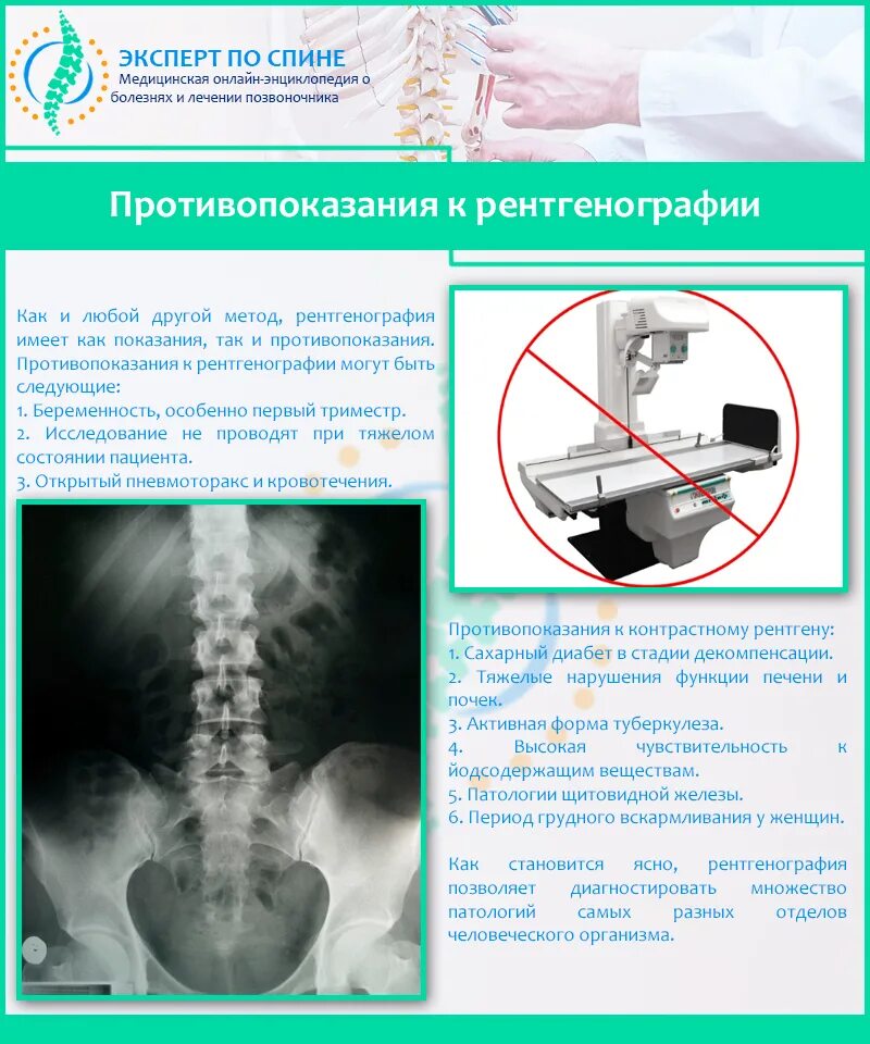 Рентген можно сделать. Показания к проведению рентгена поясничного отдела позвоночника. Рентгеноскопия противопоказания. Рентгенография противопоказания. Противопоказания к рентгену.