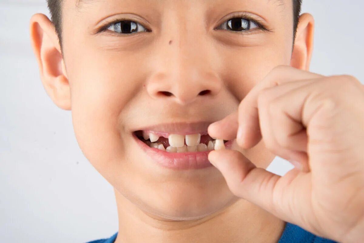 Что делать если в 13 маленький. Молочные зубы кт ребенка. Выпадение молочных зубов.