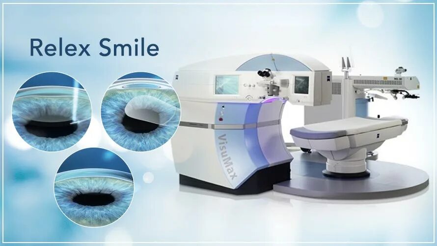 Relex smile clinicaspectr ru. Коррекция RELEX smile. RELEX smile лазерная коррекция зрения. Лазерная рефракционная кератопластика (методом Femto super LASIK). Smile рефракционная операция.