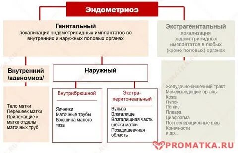 Как выявить эндометриоз у женщины