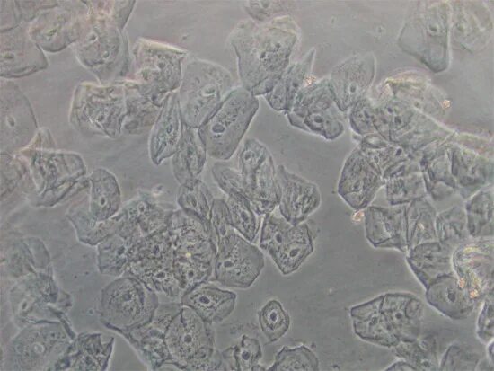 макрофаги под микроскопом. ткань под микроскопом. слюни под микроскопом. клетка слюны человека.