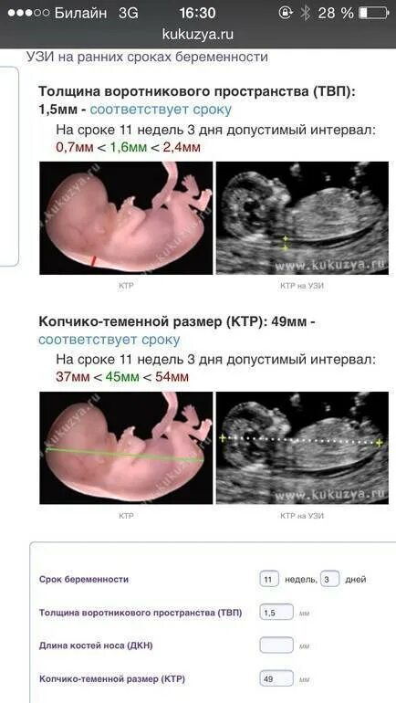 15 недель беременности узнать пол. Пол ребенка на УЗИ. УЗИ определение пола. Как по УЗИ определяют пол ребенка. УЗИ пола ребенка на 12 неделе.