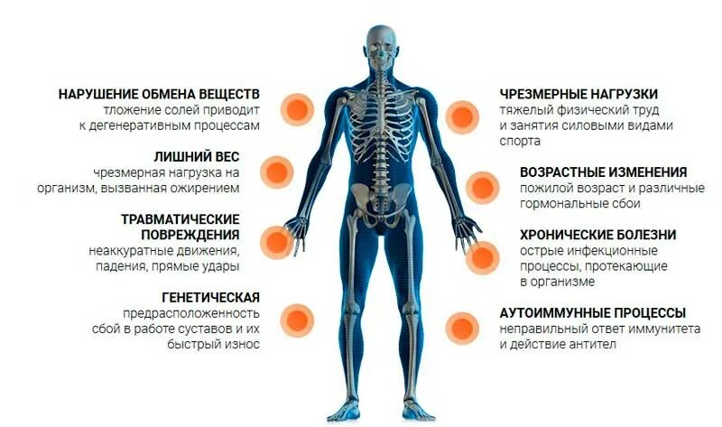 Почему заболели суставы. Перечень болезней суставов. Причины заболевания суставов. Болезни суставов список.