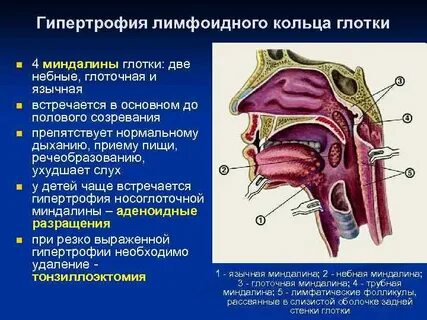 Глоточная миндалина