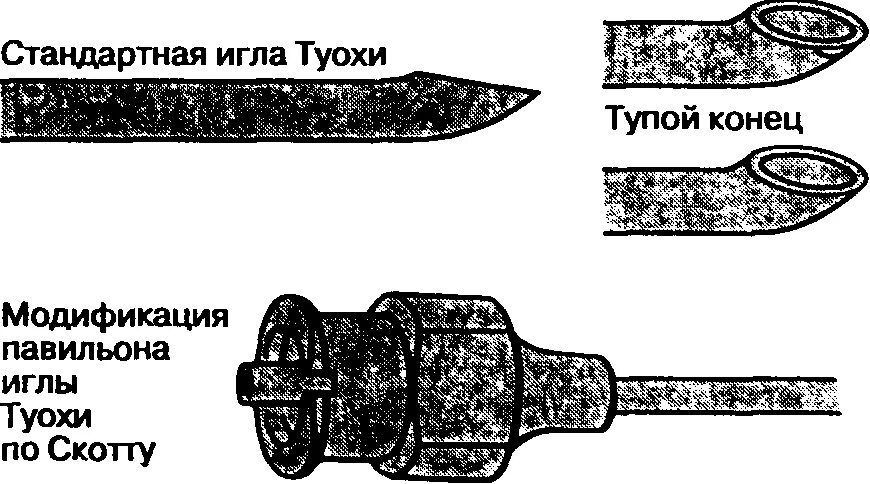 Игла туохи эпидуральная 18g 80 мм. Игла эпидуральная туохи, 16 (g). Игла туохи эпидуральная 18g 80 мм. Игла для эпидуральной анестезии туохи 18g. Игла для перидуральной пункции туохи.