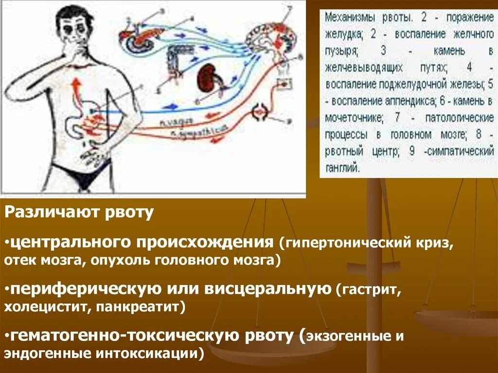 Рвотный центр мозга. Рвота механизм возникновения. Рвотный центр в головном мозге. Механизм рвотного рефлекса.