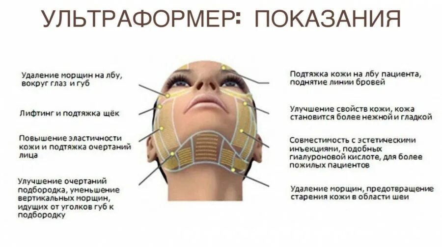 Протокол смас лифтинга. Аппарат ХИФУ для смас лифтинга. HIFU 7d аппарат смас лифтинг. Зоны лица для смас лифтинга.