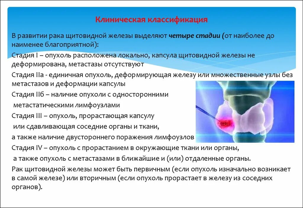 Раковая опухоль щитовидной железы. Опухоли щитовидной железы классификация. Опухоль щитовидной железы стадии. Злокачественное новообразование щитовидной железы. Можно вылечить рак полностью