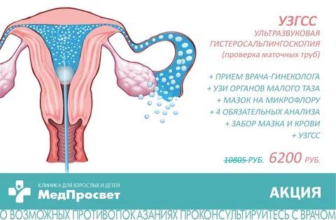 Маточные трубы отзывы