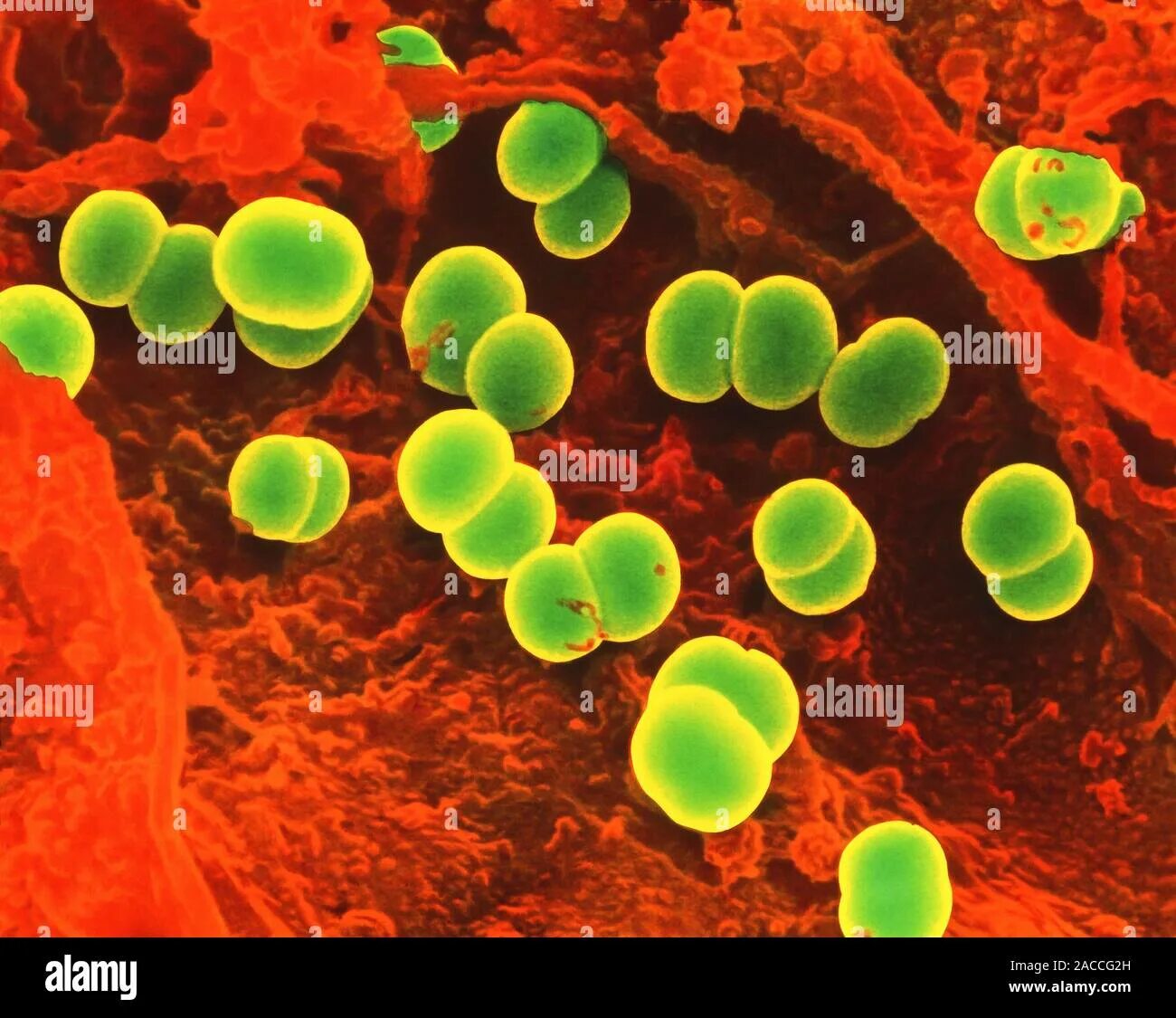 Enterococcus l3