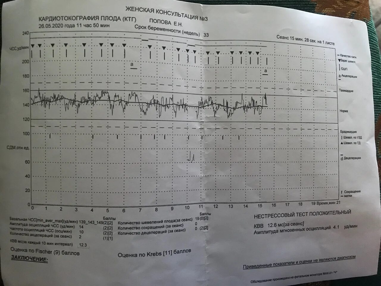 Шевеления ребенка при беременности на какой неделе. Нормальные показатели КТГ плода. КТГ Кребс норма. 8 Баллов КТГ баллы. Оценка состояния плода методом КТГ.